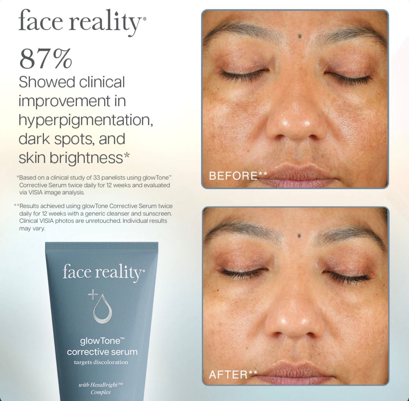 GlowTone Corrective Serum